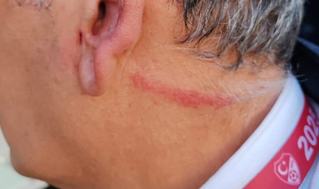 Selimiye Stadı’nda Saha Komiserine Saldırı